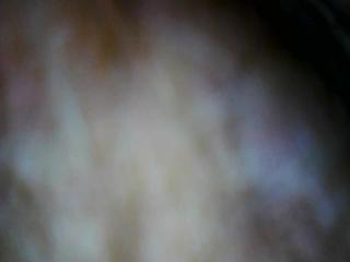 Girl Endoscope Fill up COMPILATION